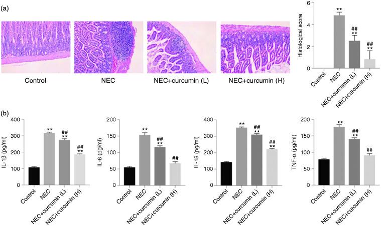 https://cdn.ncbi.nlm.nih.gov/pmc/blobs/dccd/7556186/9b2b56656e35/10.1177_1753425920933656-fig1.jpg