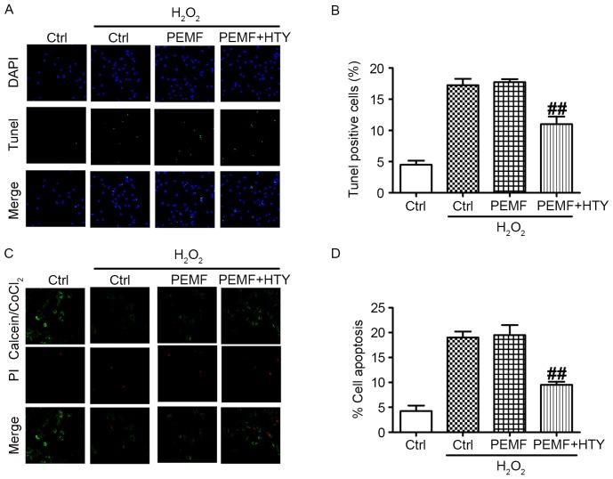 https://cdn.ncbi.nlm.nih.gov/pmc/blobs/dcd0/5779961/09803ea76f6a/MMR-16-06-8826-g02.jpg