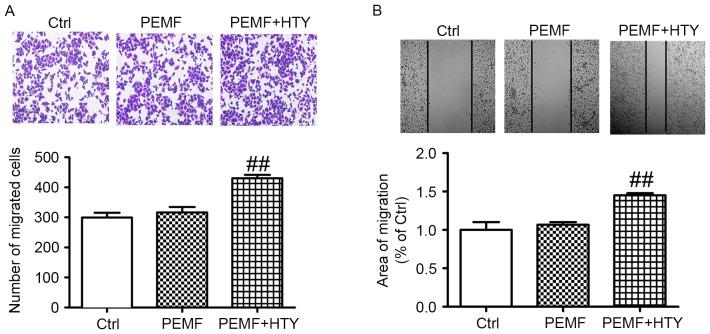 https://cdn.ncbi.nlm.nih.gov/pmc/blobs/dcd0/5779961/4dcc62a8cd84/MMR-16-06-8826-g01.jpg