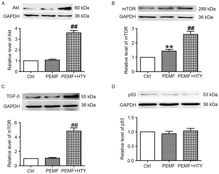 https://cdn.ncbi.nlm.nih.gov/pmc/blobs/dcd0/5779961/d7c7ecc1ecfa/MMR-16-06-8826-g04.jpg