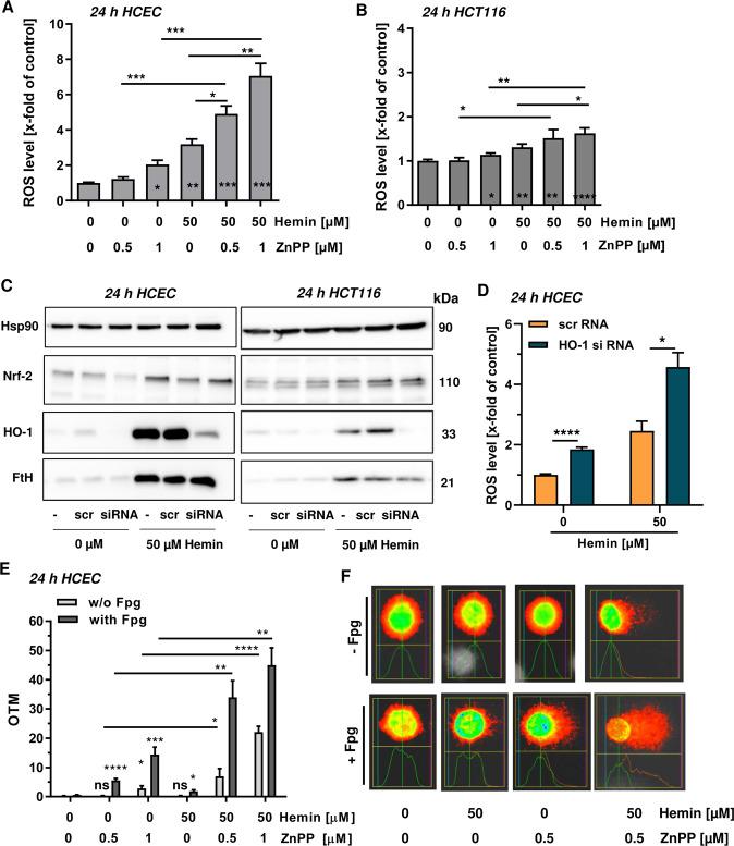 https://cdn.ncbi.nlm.nih.gov/pmc/blobs/dcd0/7511955/4c44e55c068e/41419_2020_2950_Fig5_HTML.jpg