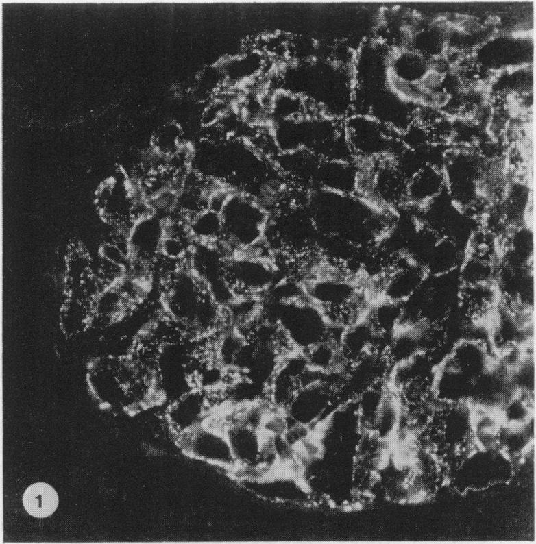 https://cdn.ncbi.nlm.nih.gov/pmc/blobs/dcd1/2040706/3f1bba5980e0/brjexppathol00108-0088-a.jpg