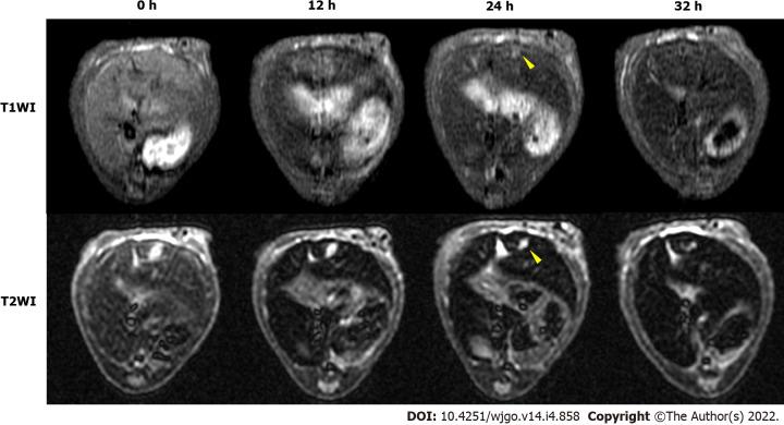 https://cdn.ncbi.nlm.nih.gov/pmc/blobs/dcd2/9048532/acdf29ec31f2/WJGO-14-858-g006.jpg