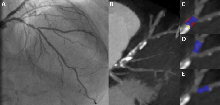 https://cdn.ncbi.nlm.nih.gov/pmc/blobs/dcd7/7806530/e811613342c9/392_2020_1658_Fig2_HTML.jpg
