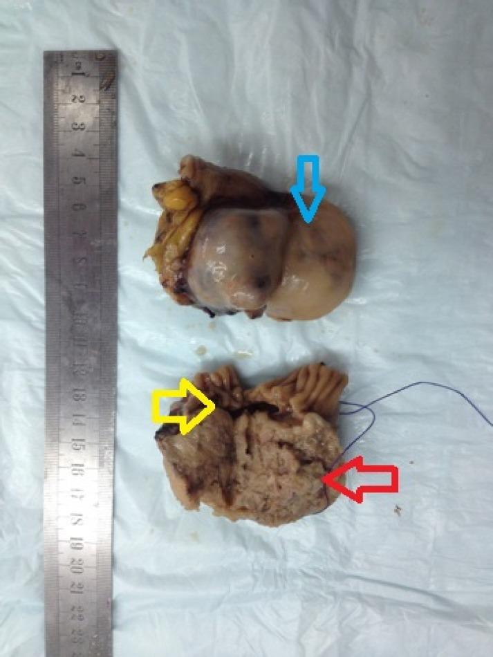 https://cdn.ncbi.nlm.nih.gov/pmc/blobs/dcd9/4803964/040f1187aa5f/GJHS-8-20-g002.jpg