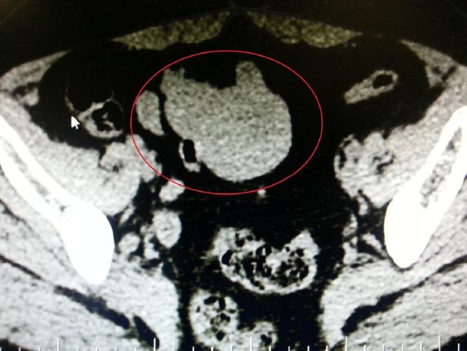 https://cdn.ncbi.nlm.nih.gov/pmc/blobs/dcd9/4803964/7719ca2cb152/GJHS-8-20-g001.jpg