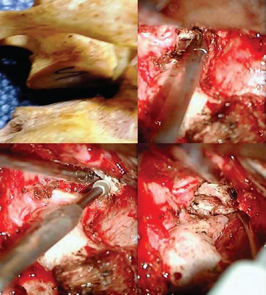 https://cdn.ncbi.nlm.nih.gov/pmc/blobs/dcd9/5225702/8729f29aafb8/JNRP-8-14-g005.jpg