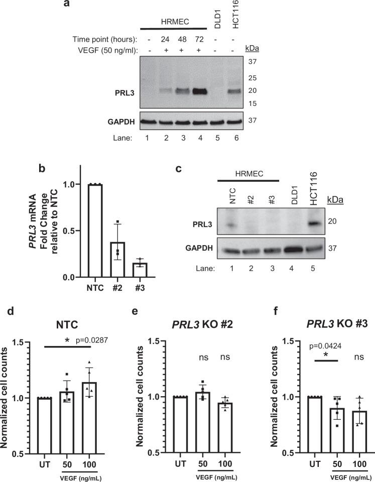 https://cdn.ncbi.nlm.nih.gov/pmc/blobs/dcda/12102187/664488557b10/41467_2025_59929_Fig4_HTML.jpg