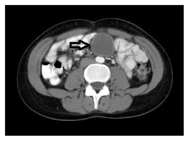 https://cdn.ncbi.nlm.nih.gov/pmc/blobs/dce1/4691465/cb2ae5b0faf6/CRIS2015-240362.001.jpg