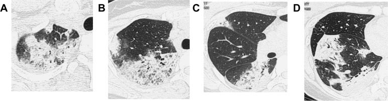 https://cdn.ncbi.nlm.nih.gov/pmc/blobs/dce5/4624096/b79ea69b93f4/ccrpm-suppl.1-2015-069f3.jpg