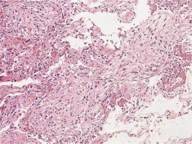 https://cdn.ncbi.nlm.nih.gov/pmc/blobs/dce5/4624096/bc1431bc98ee/ccrpm-suppl.1-2015-069f1.jpg
