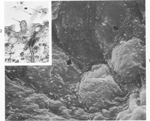https://cdn.ncbi.nlm.nih.gov/pmc/blobs/dce7/1904061/fb516a0bcde6/amjpathol00249-0119-a.jpg