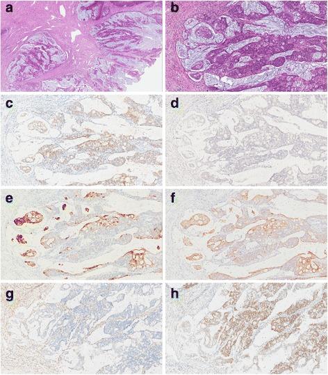 https://cdn.ncbi.nlm.nih.gov/pmc/blobs/dced/5427532/69494f5de83c/13000_2017_629_Fig2_HTML.jpg