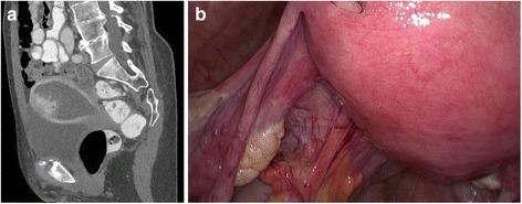https://cdn.ncbi.nlm.nih.gov/pmc/blobs/dced/5427532/e6e08ad49556/13000_2017_629_Fig1_HTML.jpg