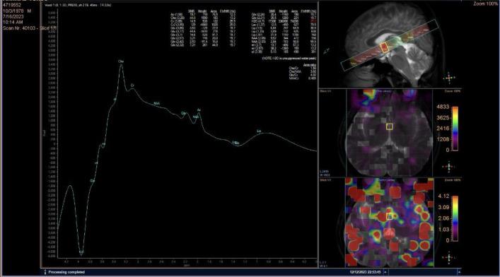 https://cdn.ncbi.nlm.nih.gov/pmc/blobs/dcf1/12059955/e6cc7904b73b/NarraJ-5-e2178-g003.jpg