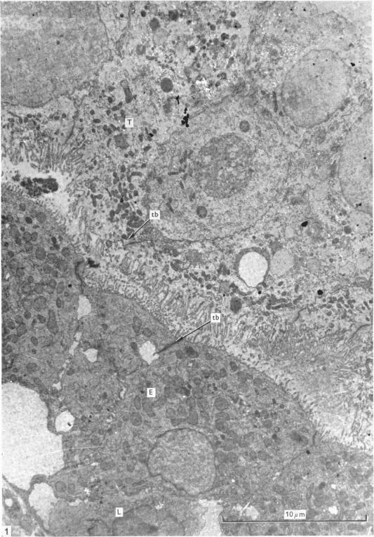 https://cdn.ncbi.nlm.nih.gov/pmc/blobs/dcf8/1232191/151613761e75/janat00398-0135-a.jpg