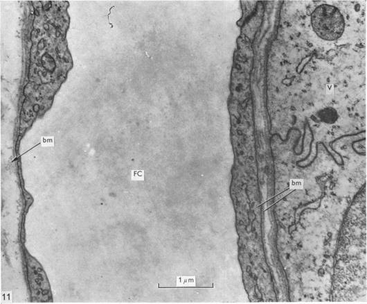 https://cdn.ncbi.nlm.nih.gov/pmc/blobs/dcf8/1232191/22d2be4277f8/janat00398-0146-a.jpg