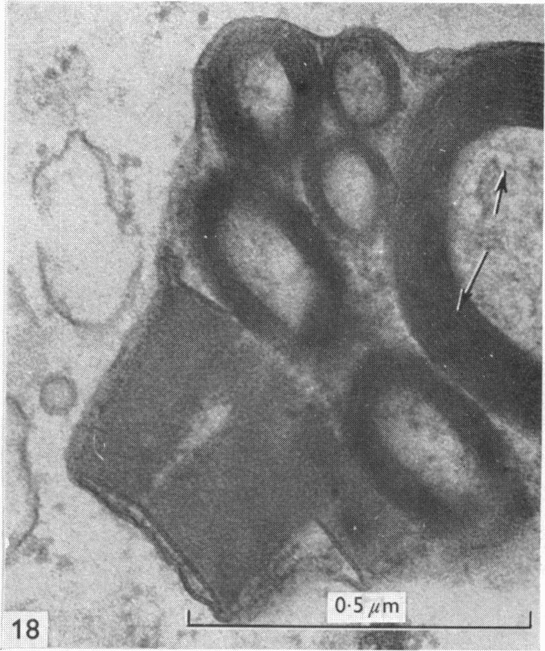 https://cdn.ncbi.nlm.nih.gov/pmc/blobs/dcf8/1232191/5a8dc57f4b3d/janat00398-0152-b.jpg