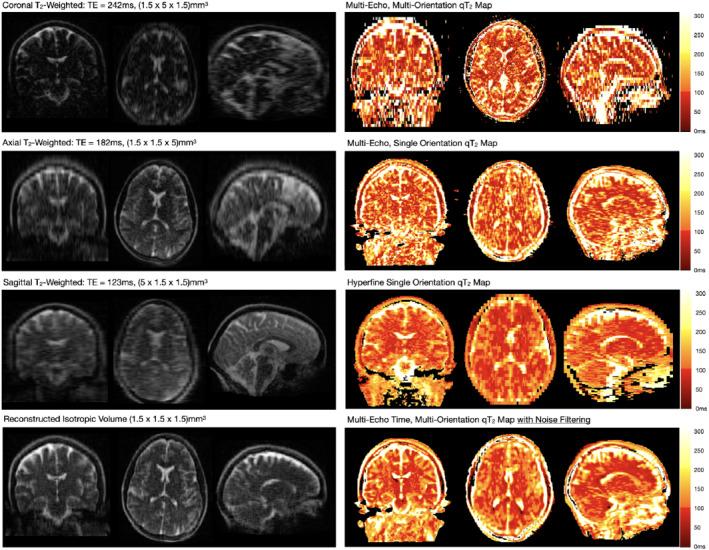 https://cdn.ncbi.nlm.nih.gov/pmc/blobs/dcfc/9322579/955c7bb6f84b/MRM-88-1273-g002.jpg