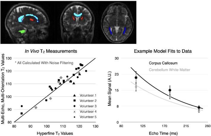 https://cdn.ncbi.nlm.nih.gov/pmc/blobs/dcfc/9322579/f02cfc3cfadb/MRM-88-1273-g001.jpg