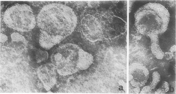https://cdn.ncbi.nlm.nih.gov/pmc/blobs/dcff/423001/03af14c191cd/iai00249-0258-a.jpg