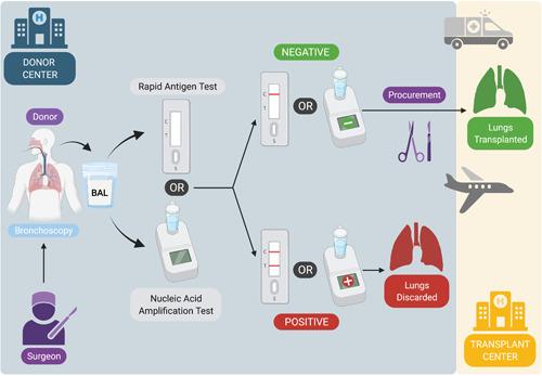 https://cdn.ncbi.nlm.nih.gov/pmc/blobs/dd04/8939038/82ff0f885e2d/IID3-10-e603-g003.jpg