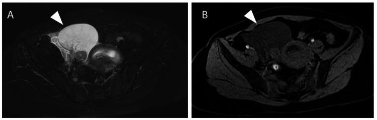 https://cdn.ncbi.nlm.nih.gov/pmc/blobs/dd0c/11167575/9ff294628eab/cureus-0016-00000060194-i02.jpg