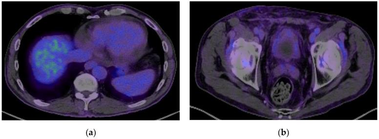 https://cdn.ncbi.nlm.nih.gov/pmc/blobs/dd0c/12109492/1a00724ad257/biomedicines-13-01118-g005.jpg