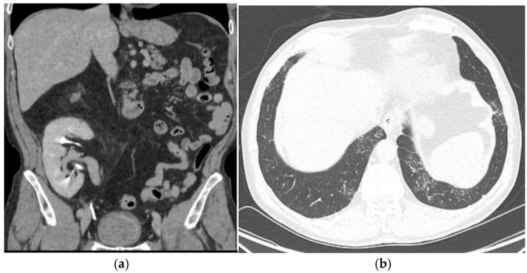 https://cdn.ncbi.nlm.nih.gov/pmc/blobs/dd0c/12109492/8ffef0c46c16/biomedicines-13-01118-g001.jpg