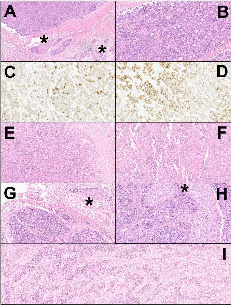 https://cdn.ncbi.nlm.nih.gov/pmc/blobs/dd0f/11464565/8e2eb5a97e68/12029_2024_1113_Fig1_HTML.jpg