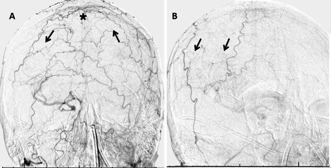 https://cdn.ncbi.nlm.nih.gov/pmc/blobs/dd12/9245762/19a1061af040/CASE2177f2.jpg