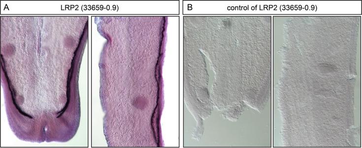 https://cdn.ncbi.nlm.nih.gov/pmc/blobs/dd14/11299980/deec3e1ffbc0/elife-88294-fig3-figsupp2.jpg