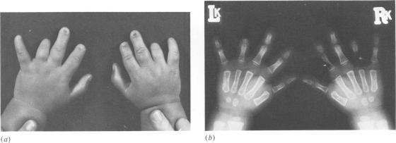https://cdn.ncbi.nlm.nih.gov/pmc/blobs/dd17/1013659/395b648303ac/jmedgene00297-0037-c.jpg