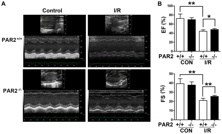 https://cdn.ncbi.nlm.nih.gov/pmc/blobs/dd21/6755170/2ddca9f546c2/MMR-20-04-3764-g02.jpg