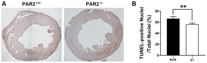 https://cdn.ncbi.nlm.nih.gov/pmc/blobs/dd21/6755170/3e27eaad3833/MMR-20-04-3764-g04.jpg