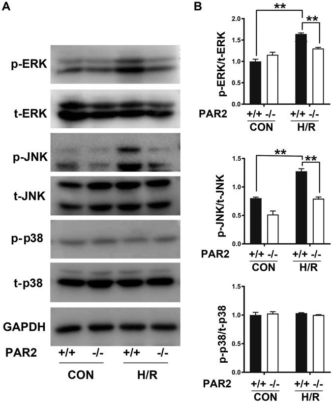 https://cdn.ncbi.nlm.nih.gov/pmc/blobs/dd21/6755170/68e7b97f3c6b/MMR-20-04-3764-g07.jpg