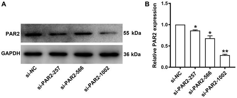 https://cdn.ncbi.nlm.nih.gov/pmc/blobs/dd21/6755170/796dc8551638/MMR-20-04-3764-g00.jpg