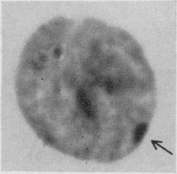 https://cdn.ncbi.nlm.nih.gov/pmc/blobs/dd30/2642322/32ce23af20ca/jnma00686-0017-a.jpg