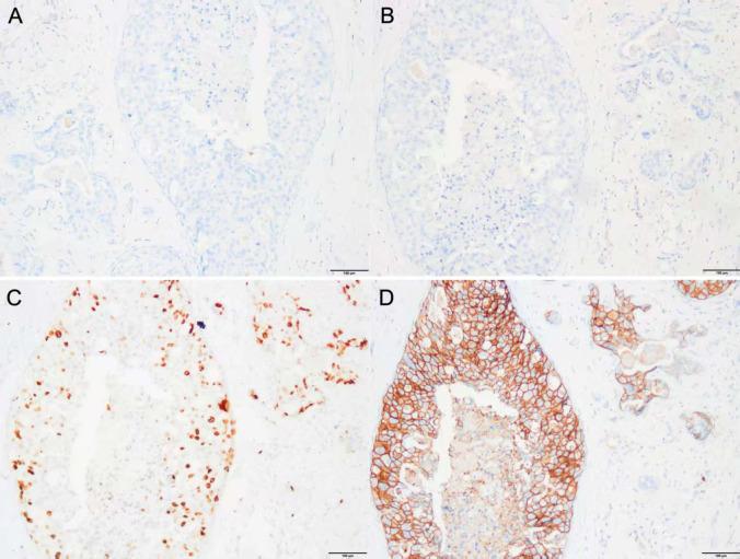 https://cdn.ncbi.nlm.nih.gov/pmc/blobs/dd37/12378505/8bd550b7de87/fonc-15-1560366-g002.jpg