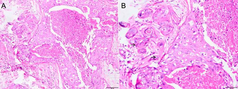 https://cdn.ncbi.nlm.nih.gov/pmc/blobs/dd37/12378505/8e71332f9d99/fonc-15-1560366-g001.jpg
