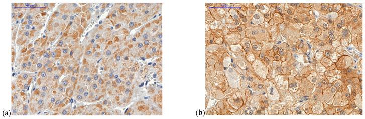 https://cdn.ncbi.nlm.nih.gov/pmc/blobs/dd3c/7866180/77d2bd38849b/ijms-22-01238-g004a.jpg