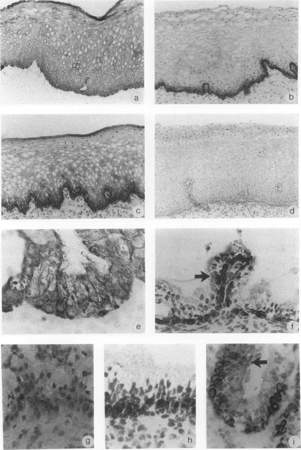 https://cdn.ncbi.nlm.nih.gov/pmc/blobs/dd41/1886162/f7abc51c60b9/amjpathol00087-0083-a.jpg