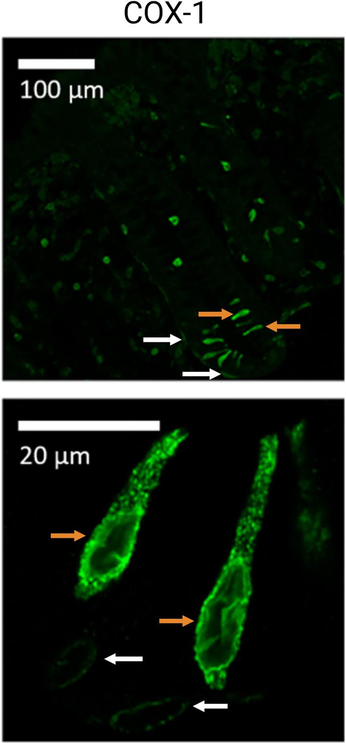 https://cdn.ncbi.nlm.nih.gov/pmc/blobs/dd41/8884241/9f86400ed783/fimmu-13-822867-g003.jpg