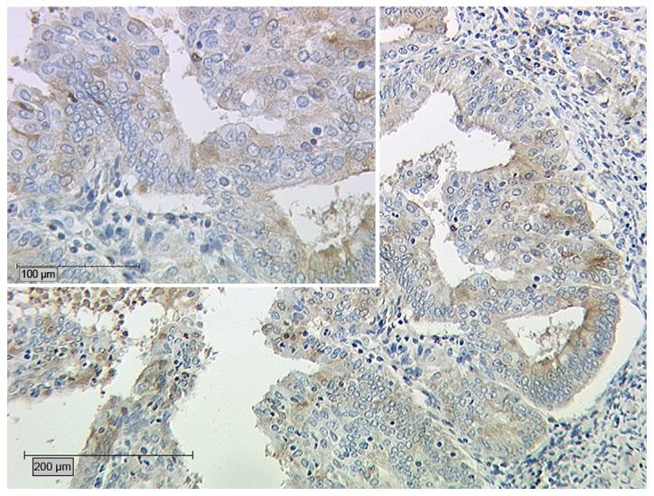 https://cdn.ncbi.nlm.nih.gov/pmc/blobs/dd43/5588003/04d60109a801/ol-14-03-3302-g05.jpg