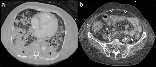 https://cdn.ncbi.nlm.nih.gov/pmc/blobs/dd4f/5265192/0d69c0923763/13244_2016_525_Fig15_HTML.jpg