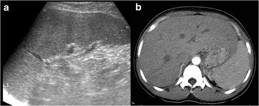 https://cdn.ncbi.nlm.nih.gov/pmc/blobs/dd4f/5265192/b3d0e170e74b/13244_2016_525_Fig5_HTML.jpg