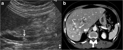 https://cdn.ncbi.nlm.nih.gov/pmc/blobs/dd4f/5265192/c8d9de64db10/13244_2016_525_Fig10_HTML.jpg