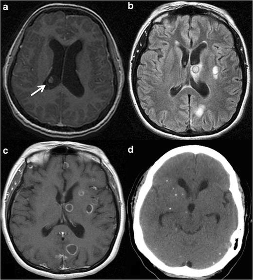 https://cdn.ncbi.nlm.nih.gov/pmc/blobs/dd4f/5265192/f27ecb3d177e/13244_2016_525_Fig8_HTML.jpg