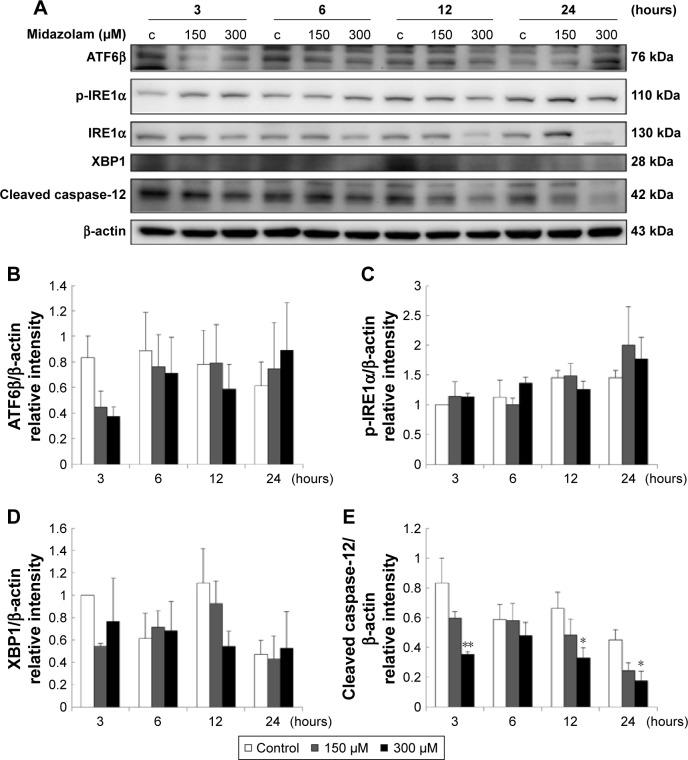 https://cdn.ncbi.nlm.nih.gov/pmc/blobs/dd52/5858853/7134e994ae44/ott-11-1475Fig6.jpg