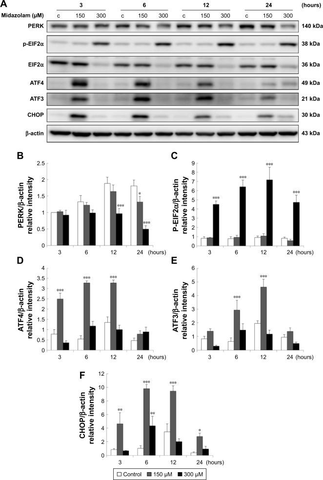https://cdn.ncbi.nlm.nih.gov/pmc/blobs/dd52/5858853/b5b451a68552/ott-11-1475Fig7.jpg